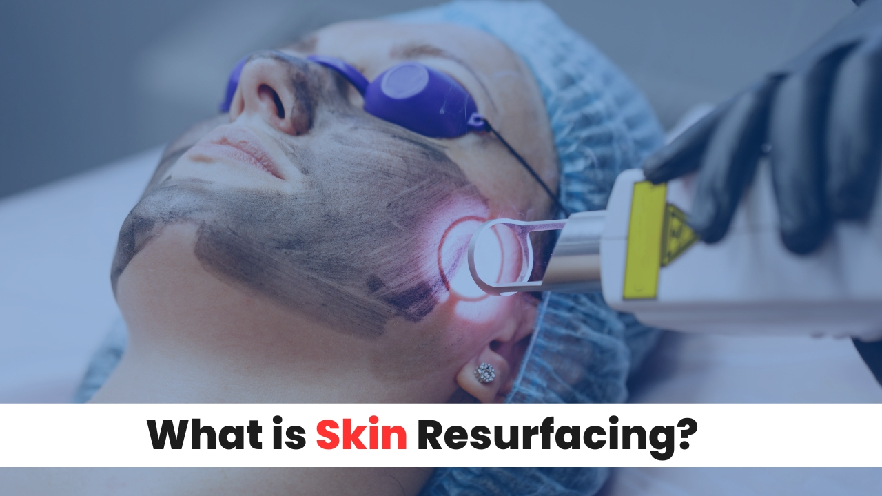 How Skin Resurfacing Transforms and Its Benefits